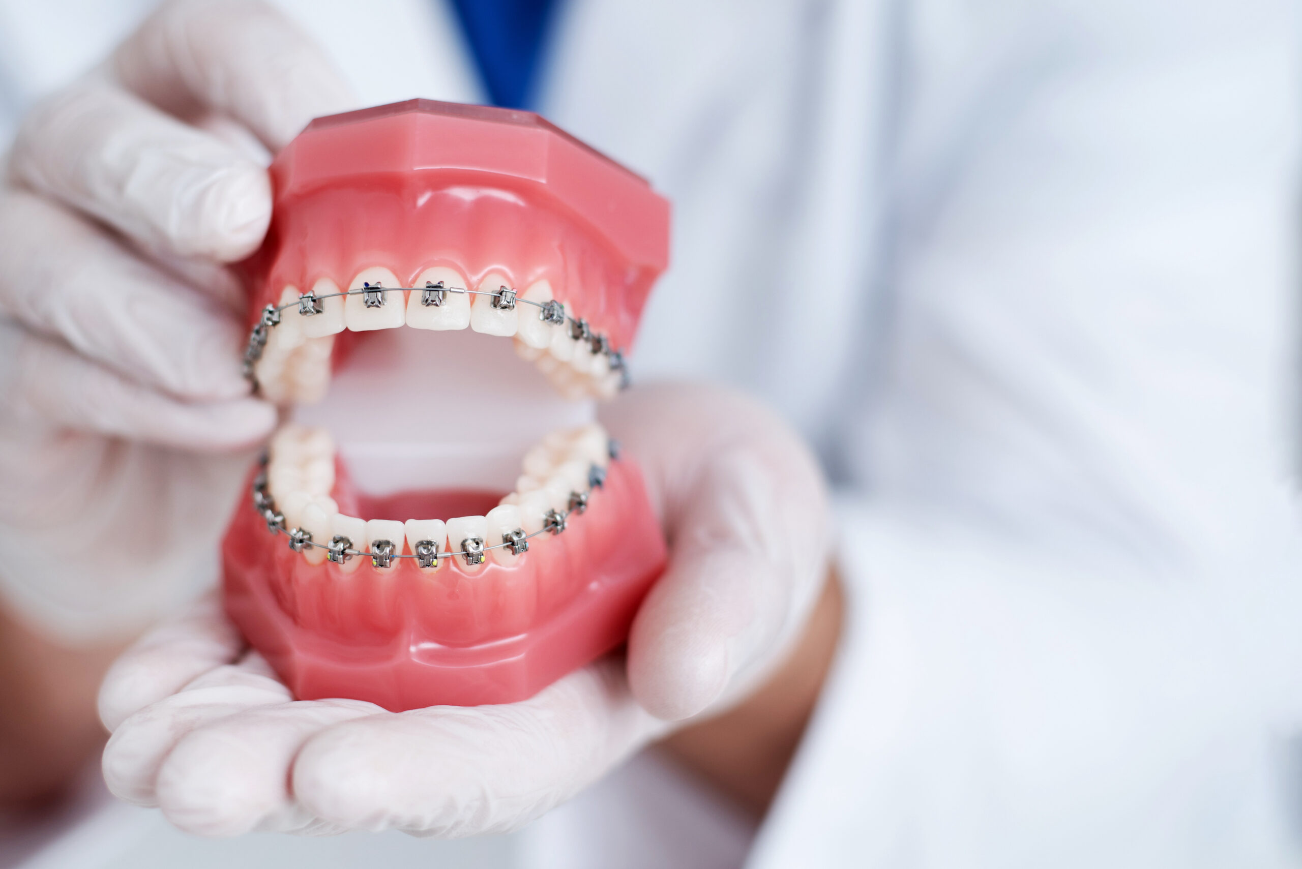 When To Get Braces Melbourne Orthodontics