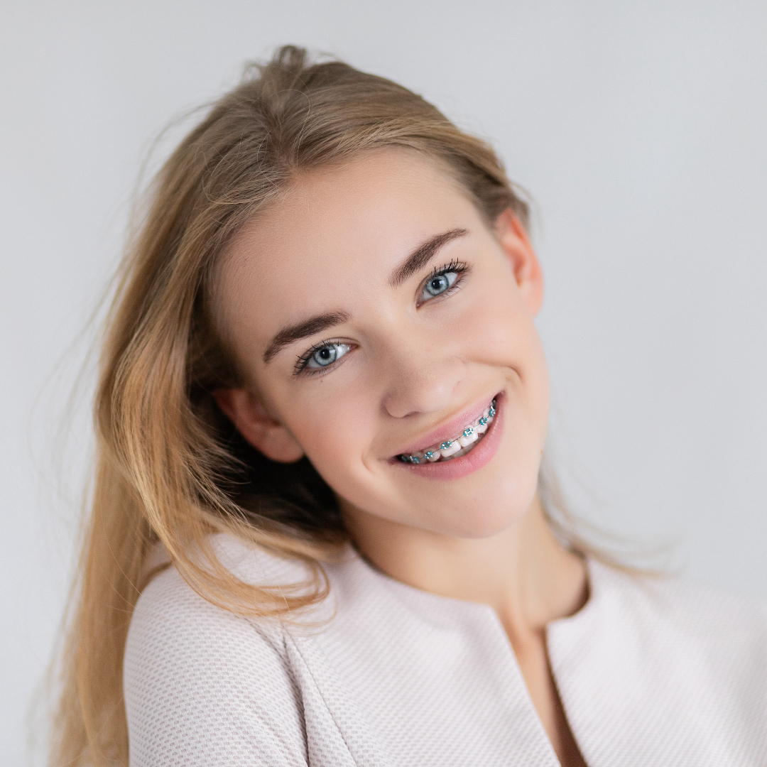 Misconceptions About Braces Melbourne Orthodontics